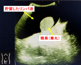 陰嚢が腫れる原因 中野駅前ごんどう泌尿器科